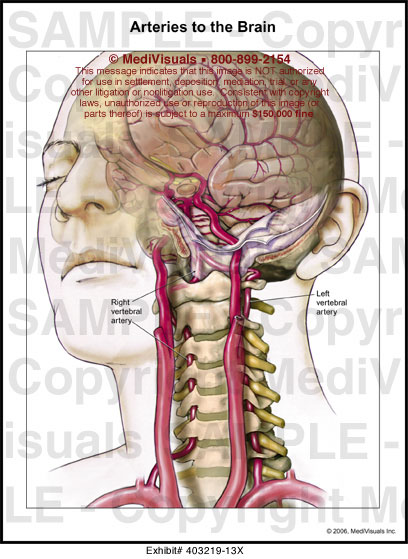 Arteries to the Brain Medical Illustration Medivisuals