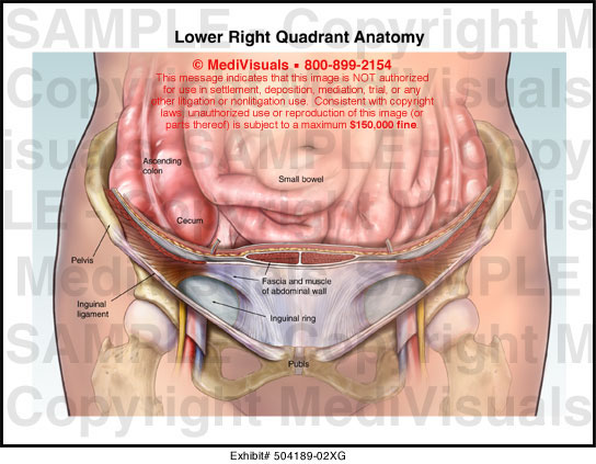 Lower Right Quadrant Anatomy Medical Illustration